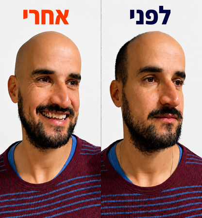 VelunoPro™ - מארז הגילוח